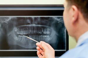 8 Situations That Call For Dental X-Rays