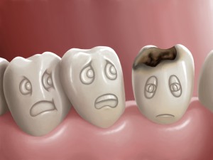 Digital representation of healthy teeth being afraid of a decaying tooth next to them.