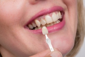 Common Dental Crown Problems and Solutions