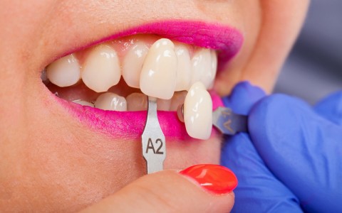 Dental shade determination with shade guide. Female patient wearing pink lipstick close up