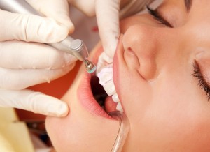 A close-up view of a female patient having her teeth cleaned by a dental hygienist.