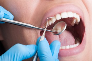 Four Benefits of Regular Tooth Cleaning Visits