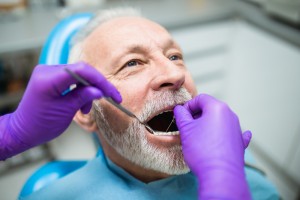 Close-up view of a senior citizen man having a dental exam. 