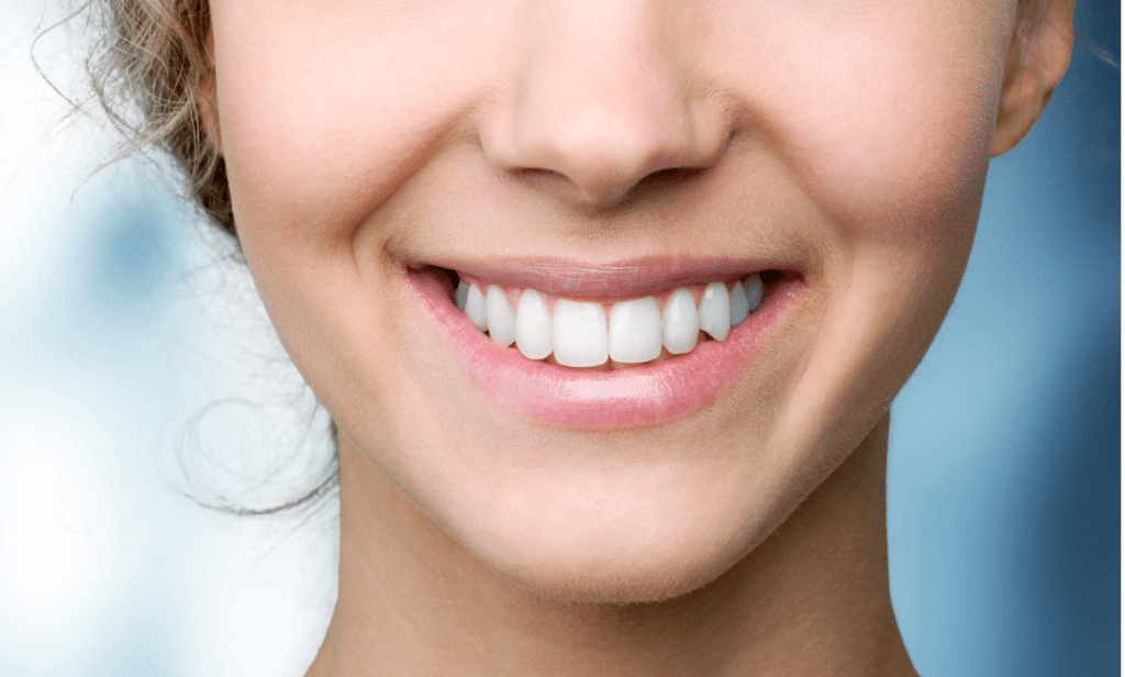 økse Stereotype plan Show Off Your Sparkling White Smile During National Smile Month | Angela  Evanson, DDS in Parker, CO Dentist | (720) 409-0008 | 80134